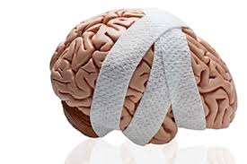 Concussion Management Training for Health Techs